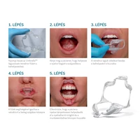 Kép 2/2 - Szájterpesz Umbrella medium 5db