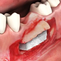 Kép 7/7 - OsteoBiol Sp-Block 10x10x20mm szárított blokk normál