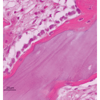 Kép 5/9 - Osteobiol TSV Gel 1 fecskendő kit + Gen-Os 0,5gr