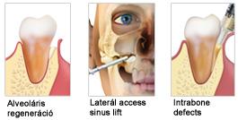 osteobiol_indikaciok_special.jpg