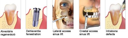 osteobiol_indikaciok_gen-os.jpg