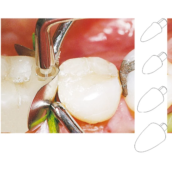 Kontaktpont formázó sort. LM 120db. 4x30db/méret