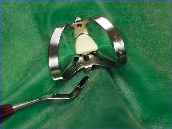 Kofferdám gumi 15x15cm medium zöld 36db