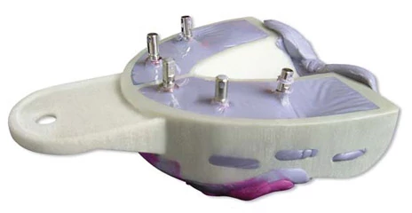 Miratray Implant felső OK S2 medium  6db