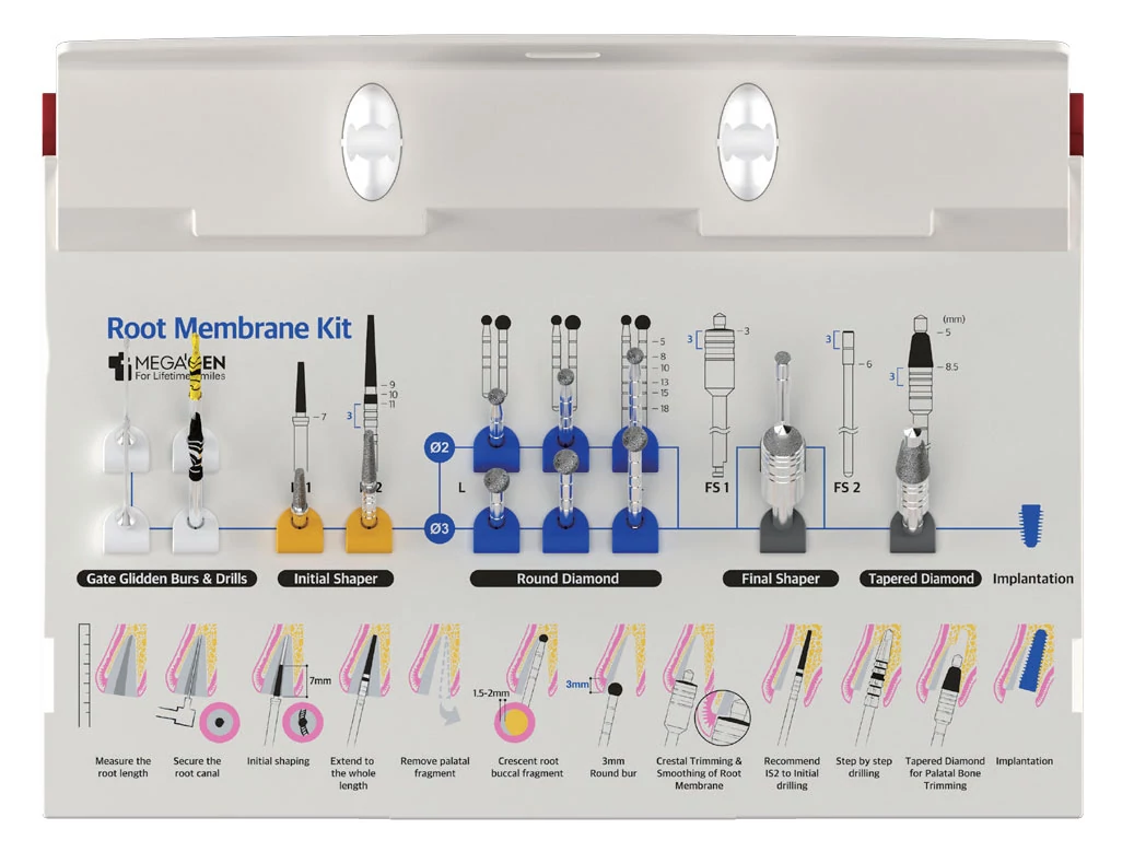 Root Membrane Kit [CM]